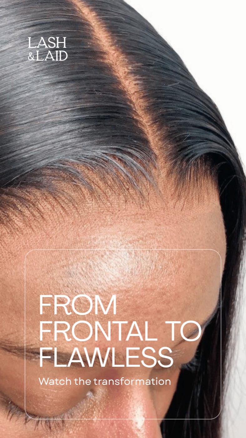 Frontal installation